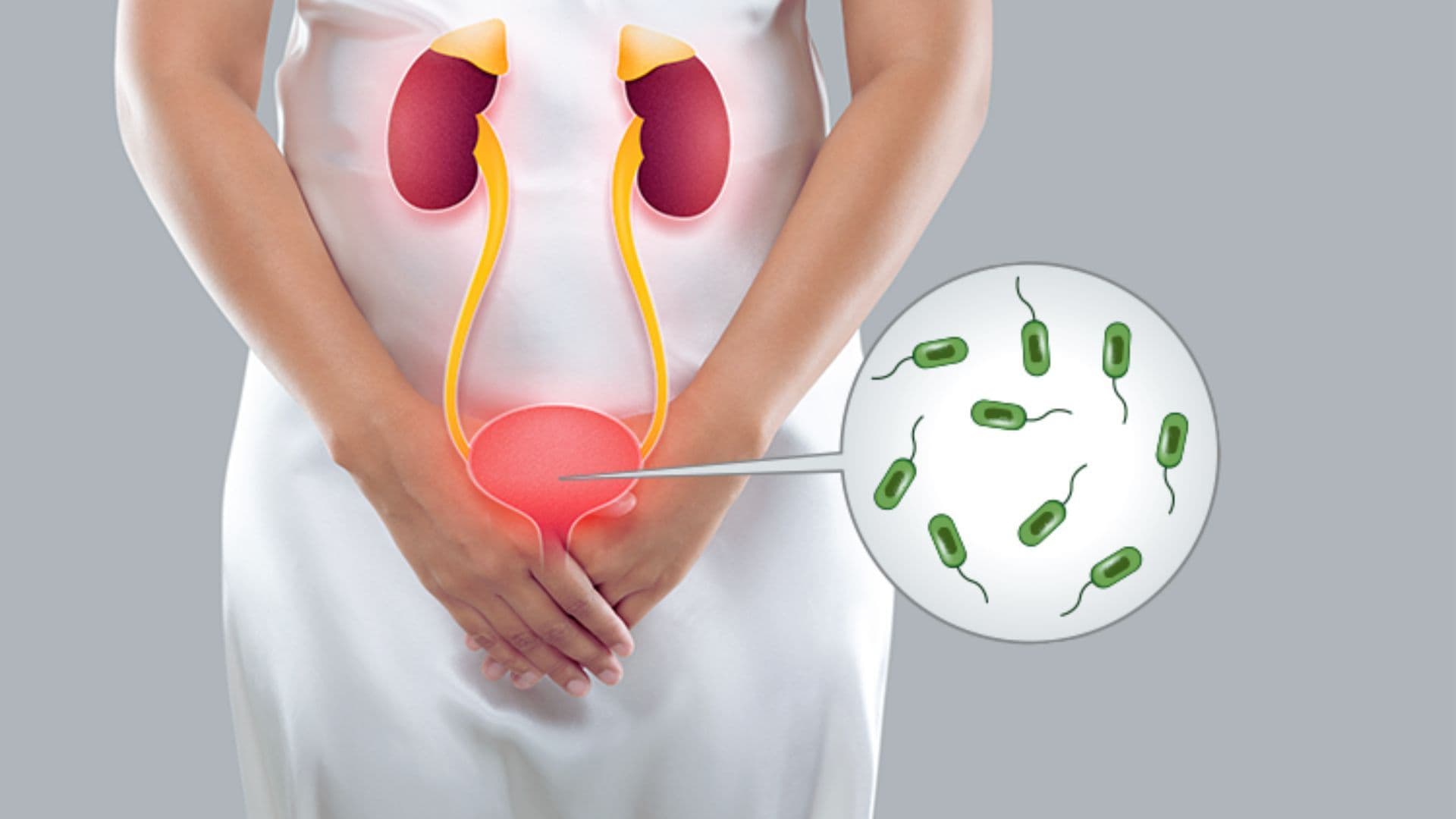 Urinary Tract Infection (UTI)