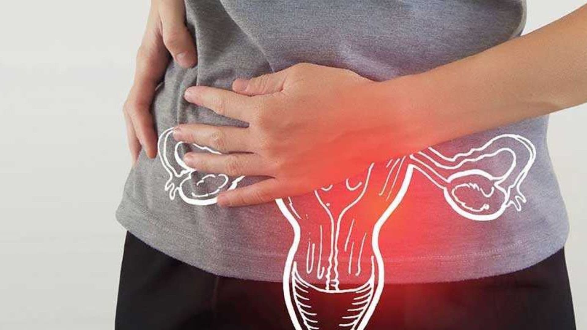 Polycystic Ovary Disorder (PCOD)