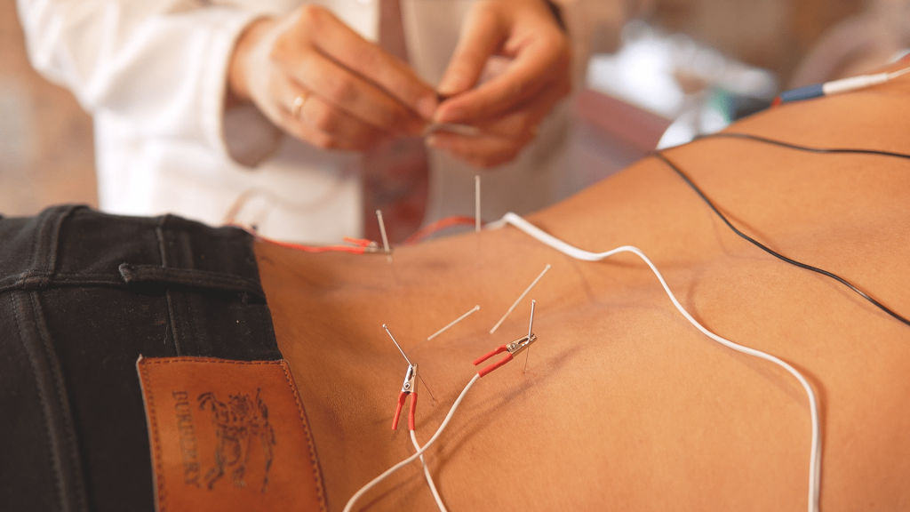 Electroacupuncture